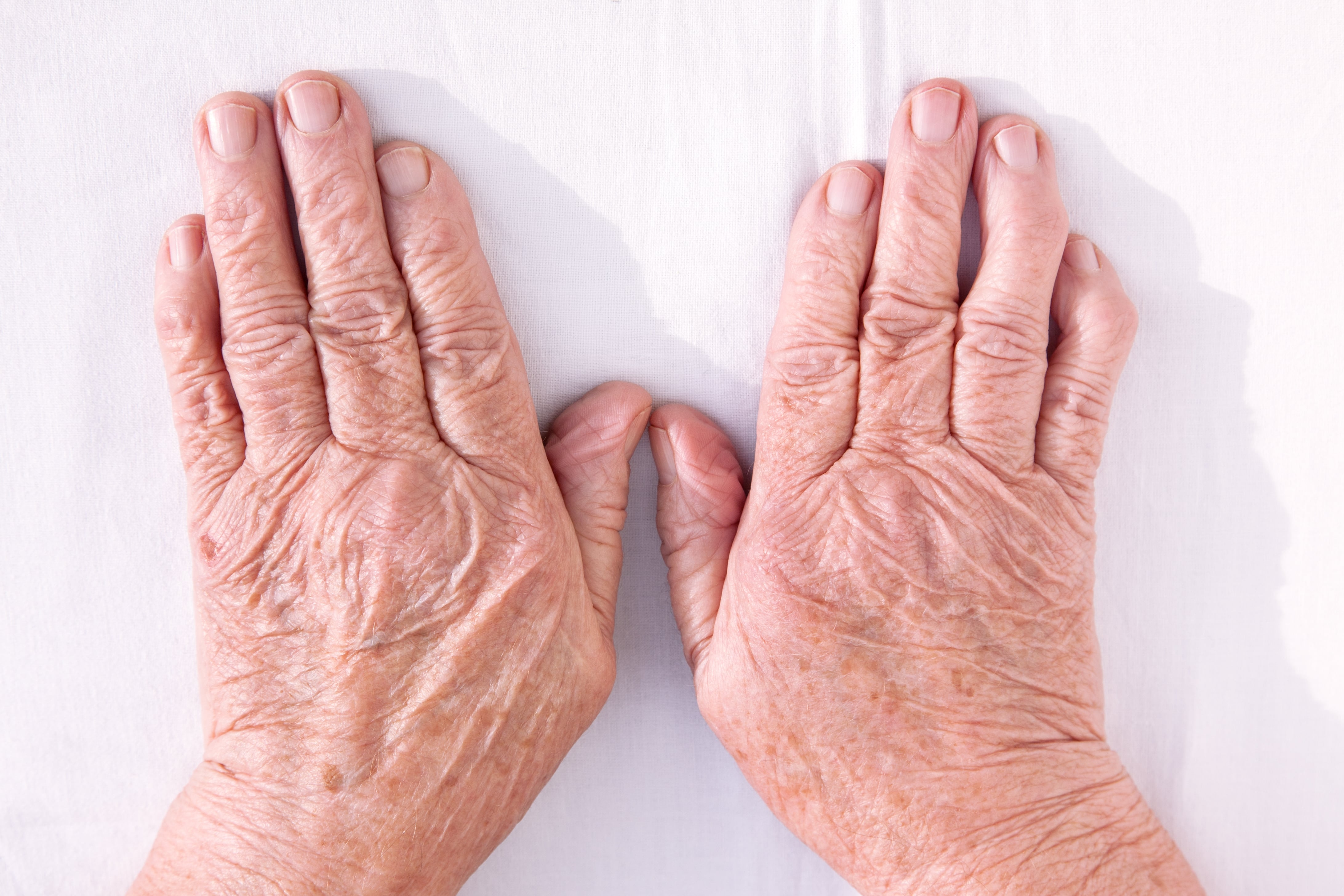 An old, wrinkled pair of hands